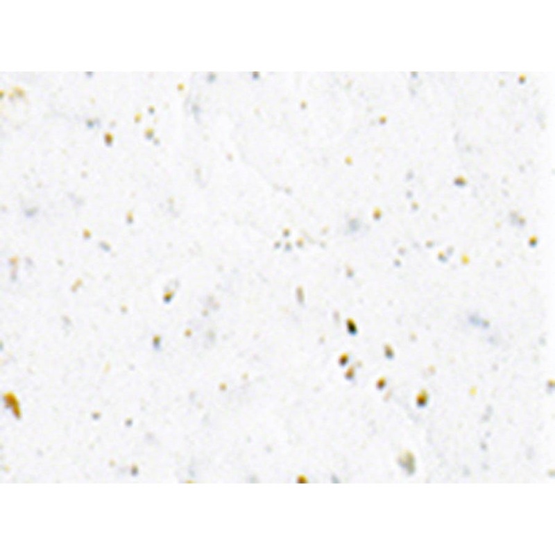 Gel Ribbon Bar Tape – White White